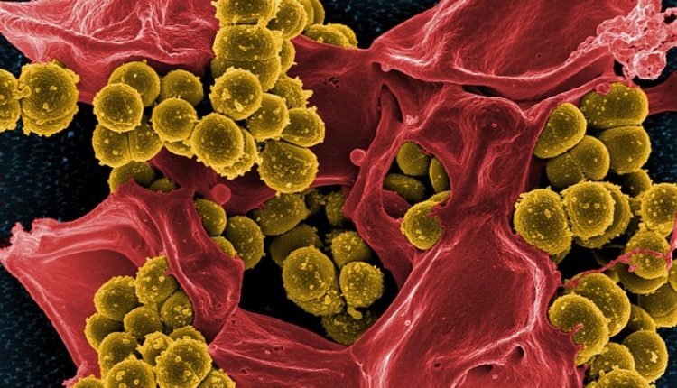 Alarmantno: Nova smrtonosna superbakterija preti svetu – Amerikanci u panici