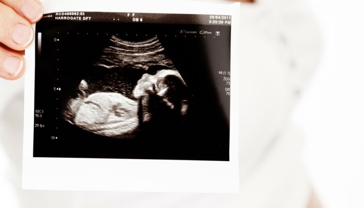 Retke bolesti mogu da se otkriju kod beba još pre rođenja Retke bolesti mogu da se otkriju kod beba još pre rođenja