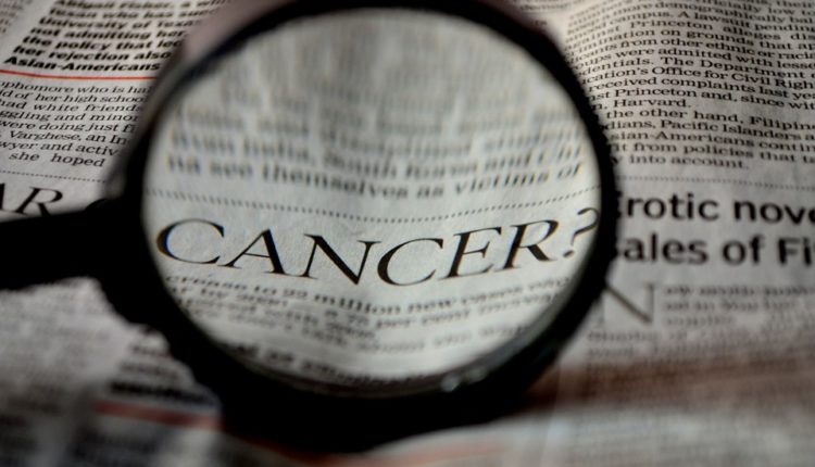 Revolucionarno otkriće: Ubrzanje jona ubija ćelije raka