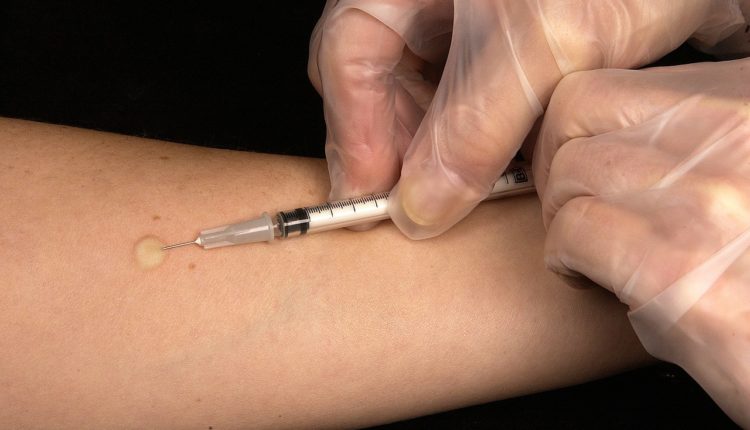 Vakcinacija: pitanja i odgovori stručnjaka? Vakcinacija: pitanja i odgovori stručnjaka?
