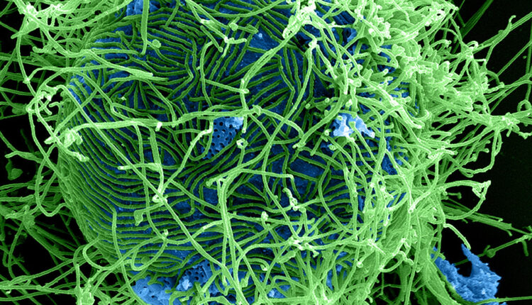 Opasnost iz mikrosvemira: Ovi virusi prete da desetkuju čovečanstvo