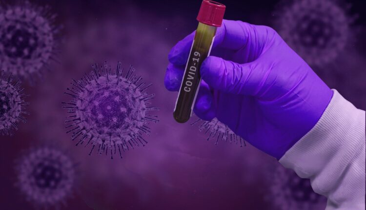 Dobijen prvi protein za domaći test na antitela na novi koronavirus