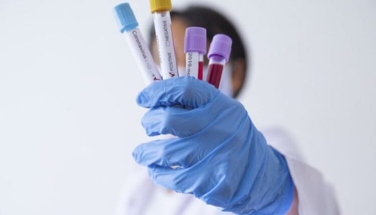 Jednostavan test krvi može otkriti više od 50 vrsta karcinoma Jednostavan test krvi može otkriti više od 50 vrsta karcinoma