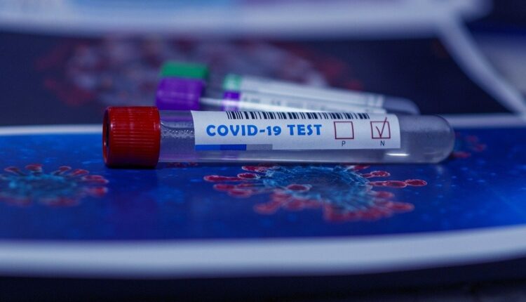 Evo koliko ćete platiti testiranje na koronu na lični zahtev Evo koliko ćete platiti testiranje na koronu na lični zahtev