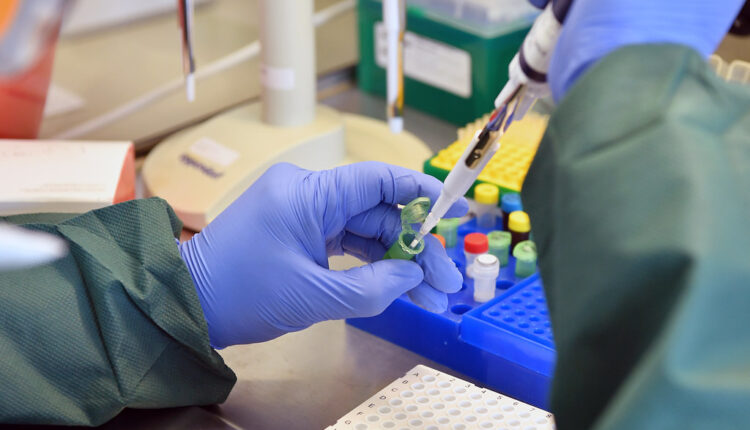 Srbija uvodi PCR test i karantin za strance? Srbija uvodi PCR test i karantin za strance?