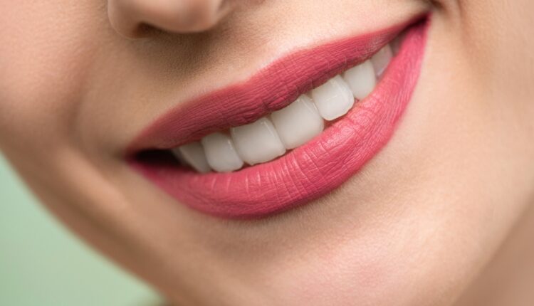 Kako izbeliti zube kod kuće i ne naneti im štetu: 1 sastojak daje sjajan efekat već nakon prve upotrebe