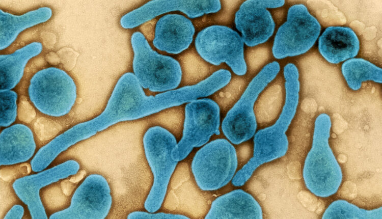Više od 90 posto ljudi nosi ‘uspavani virus’