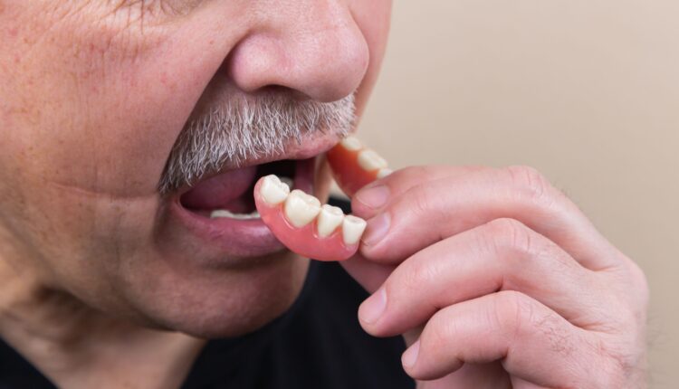 Neverovatno otkriće: Mozak dodatno ostari zbog svakog izgubljenog zuba, evo i koliko