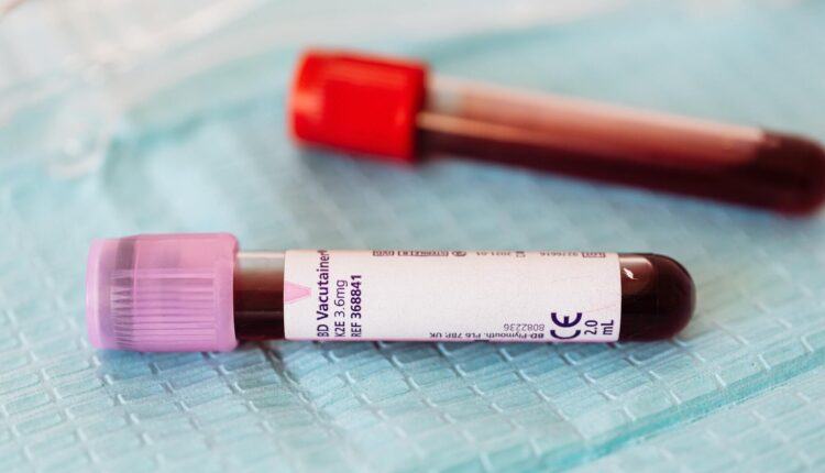 Vaša krvna grupa otkriva kojim ste bolestima skloni
