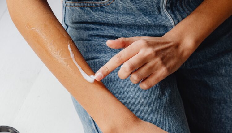 Krema za ožiljke: Rešite se tragova na koži uz pomoću ovog domaćeg preparata
